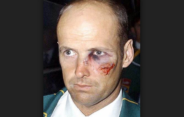 গ্যারি কার্স্টেন : ২০০৩-০৪ সাল। পাকিস্তানের শোয়েব আখতার তখন আগুন ছোটাচ্ছেন। প্রথম ইনিংসে ব্যাট করতে নেমে চোট পান কার্স্টেন। এক্স-রেতে দেখা যায় তার নাকের হাড় ভেঙেছে। দ্বিতীয় ইনিংসে দলের স্কোর এক সময় ১৪৯ রানে চার উইকেট। সবাইকে অবাক করে ব্যাট করতে নামেন কার্স্টেন। এই অবস্থায় ৪০-এর উপর রান করেন তিনি।