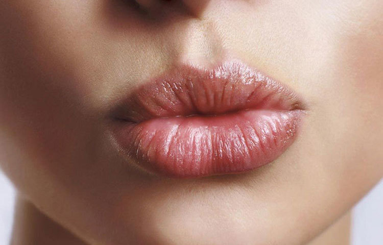 শুধু কি দেহের চামড়াই রোদে পুড়ে যায়? ঠোঁটেও একই ভাবে সানবার্ন হয়। অতি বেগুনি রশ্মি থেকে তাই ঠোঁটকে রক্ষা করা খুব জরুরি। খুব বেশি রোদে ঘোরাঘুরি করবেন না।