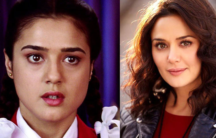 বোটক্স সার্জারি করেছিলেন অভিনেত্রী প্রীতি জিরতাও। যদিও মিডিয়ার কাছে পুরোপুরি চেপে যান বিষয়টা। তবে অস্বীকার করলে কী হবে, ছবিই তো বলে দিচ্ছে যে, প্রীতি কসমেটিক্স সার্জারি করেছিলেন।