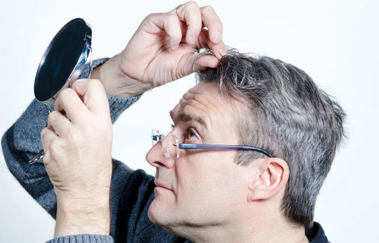 কম বয়সে চুল পাকার ফলে অনেকেই অস্বস্তিতে ভোগেন। ফলে বাজার থেকে হেয়ার কালার কিনে ব্যবহার করে অনেকেই নিজের পাকা চুল ঢাকার চেষ্টা করেন।