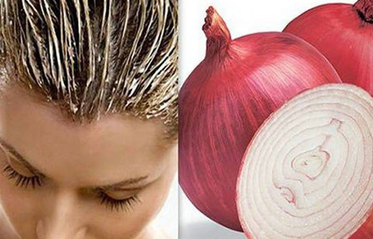 ২-৩টি পেঁয়াজ ব্লেন্ড করে রস বের করে নিন। তারপর সেটি মাথার ত্বকে মাসাজ করুন। মনে রাখবেন, রস আঙুলের ডগা দিয়ে মাথায় ত্বকে মালিশ করতে হবে। তার পর কমপক্ষে ৩০ মিনিট রেখে ধুয়ে নিন।