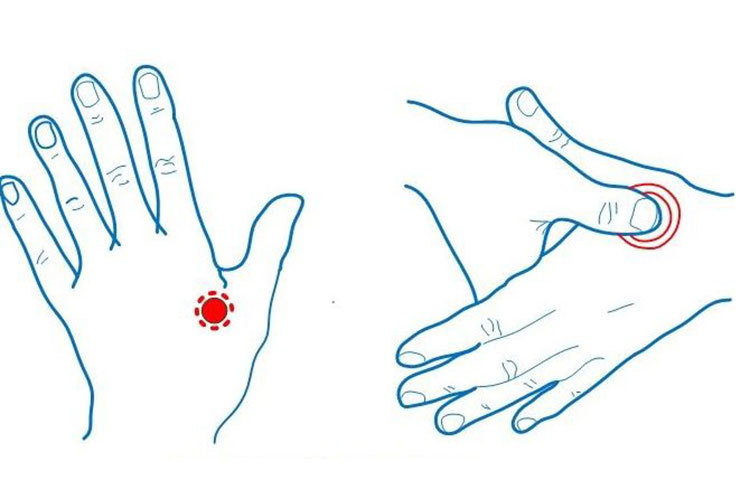 মাইগ্রেন: ডান হাতের বুড়ো আঙুল দিয়ে নির্দিষ্ট জায়গায় আলতো হাতে চাপুন।