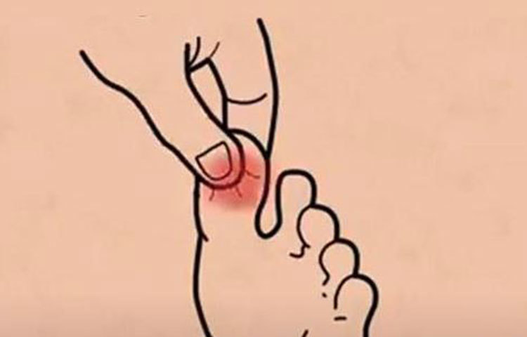 ঠান্ডা লাগা: পায়ের বুড়ো আঙুলের মাথা এভাবে চেপে ধরুন।