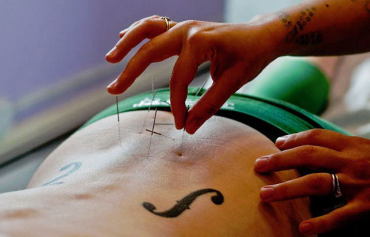 ওষুধ না খেয়ে ব্যথা কমানোর অন্যতম সেরা উপায় হল অ্যাকুপ্রেসার। এই পদ্ধতিতে শরীরে লসিকা সংবহন ভালো হয়। ফলে যন্ত্রণা কমে দ্রুত।