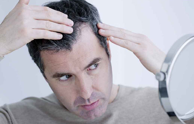 বয়সের সঙ্গে সঙ্গে হরমোনের প্রভাবেও নানা রোগের শিকার হতে হয়। তার মধ্যে অন্যতম চুলের সমস্যা। একটা সময়ের পর চুল পাতলা হয়ে আসাই স্বাভাবিক। ডাইহাইড্রোটে স্টোস্টেরনের কম ক্ষরণই এর জন্য দায়ী। চুল পাতলা হতে শুরু করলেই ঘরোয়া যত্ন নিন চুলের। সঙ্গে পরামর্শ নিন বিশেষজ্ঞদের। অকালে টাক পড়া থেকে বাঁচা তা হলে কঠিন হবে না।