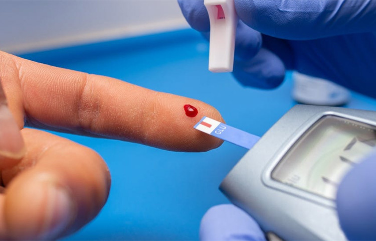 ব্লাড সুগার: খাওয়ার অভ্যাস সম্পর্কে সতর্ক না হলে ৪০ বছরের মধ্যে ডায়াবেটিসে আক্রান্ত হওয়ার সম্ভাবনা বেশি থাকে। ভুল খাবার খাওয়া এবং ওজন বাড়ানো অগ্ন্যাশয়ের উপর চাপ সৃষ্টি করতে পারে। এটি সহজেই রক্তে শর্করার মাত্রা বাড়িয়ে তুলতে পারে। রক্তের শর্করার মাত্রা রোজার জন্য নিজেকে পরীক্ষা করা ডায়াবেটিসকে তাড়াতাড়ি নিয়ন্ত্রণে রাখতে সহায়তা করে এমনটাই পরামর্শ চিকিৎসকদের।