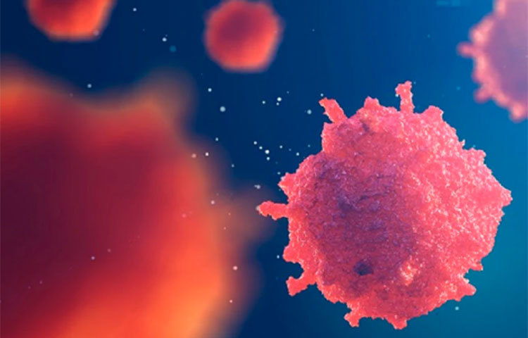 সার্কোমা ক্যান্সার: শরীরের বিভিন্ন টিস্যু যেমন পেশী, চর্বি, ত্বকের গভীরের কোষ, হাড় বা তরুনাস্থিতে বাসা বাঁধে সার্কোমা ক্যান্সার। প্রাথমিক পর্যায়ে এই ক্যান্সারের তেমন কোনো উপসর্গ প্রকাশ পায় না। সাধারণত, শিশুদের মধ্যেই এহেন ক্যান্সার বেশি দেখা যায়। এই ক্যান্সার সাধারণত দ্বিতীয় বা তৃতীয় পর্যায়ের পর বায়োপসির মাধ্যমে শনাক্ত করা যায়। কিন্তু অন্য কোনো পরীক্ষার মাধ্যমে সার্কোমা ক্যান্সার শনাক্ত করা যায় না।