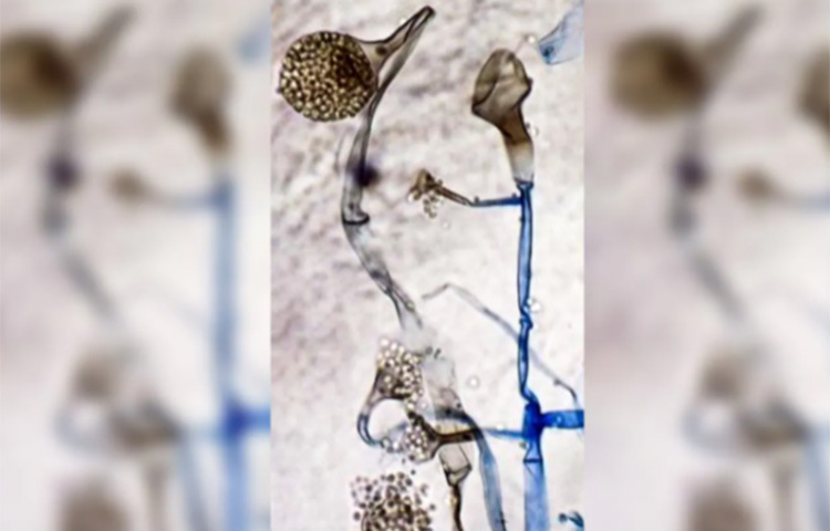 ভারতীয় স্বাস্থ্য বিশেষজ্ঞরা বলছেন, একবারও করোনা সংক্রমণ হয়নি এমন ব্যক্তিও এই রোগে আক্রান্ত হতে পারেন। সম্ভাবনা বেশি থাকছে হাই ব্ল্যাড সুগারের রোগীদের ক্ষেত্রে। তাই খুব উচ্চ মাত্রায় ডায়াবেটিস যাদের রয়েছে, তারা এখনই সাবধান হয়ে যান, এমনটাই বলছেন ভারত সরকারের স্বাস্থ্য বিভাগের সদস্য ভিকে পাল। ছবি: সংগৃহীত