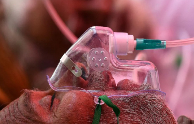 ভিকে পাল জানাচ্ছেন, ব্ল্যাক ফাঙ্গাসের আক্রমণে ৭০০-৮০০ পর্যন্ত হয়ে যেতে পারে রক্তে চিনির পরিমাণ। চিকিৎসা বিজ্ঞানের ভাষায় একে বলে ডায়াবেটিক কিটোয়াসাইডোসিস। ছবি: সংগৃহীত