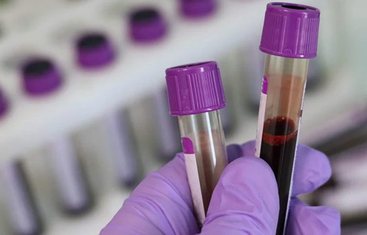 কিন্তু আপনি কি জানেন কোন ব্লাড গ্রুপের মানুষ এই ভাইরাসে সবচেয়ে বেশি আক্রান্ত হচ্ছেন আর কোন ব্লাড গ্রুপের মানুষদের মধ্যে আক্রান্তের সংখ্যা কম!