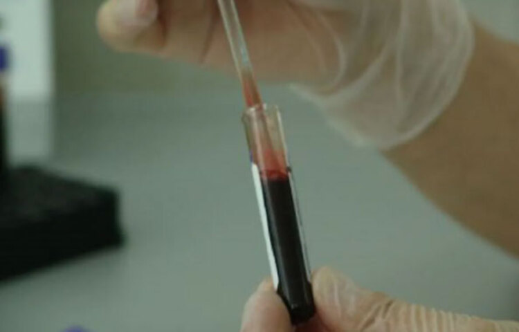 সেক্ষেত্রে স্বামীর যদি পজিটিভ গ্রুপ থাকে এবং স্ত্রী নেগেটিভ, তখন সমস্যা তৈরি হতে পারে। দেখা দিতে পারে Isoimmunization তবে এর জন্য চিকিৎসা রয়েছে। তবে বেশিরভাগ ক্ষেত্রেই তেমন কোনো ভয়ের নয় বলে চিকিৎকদের মত।