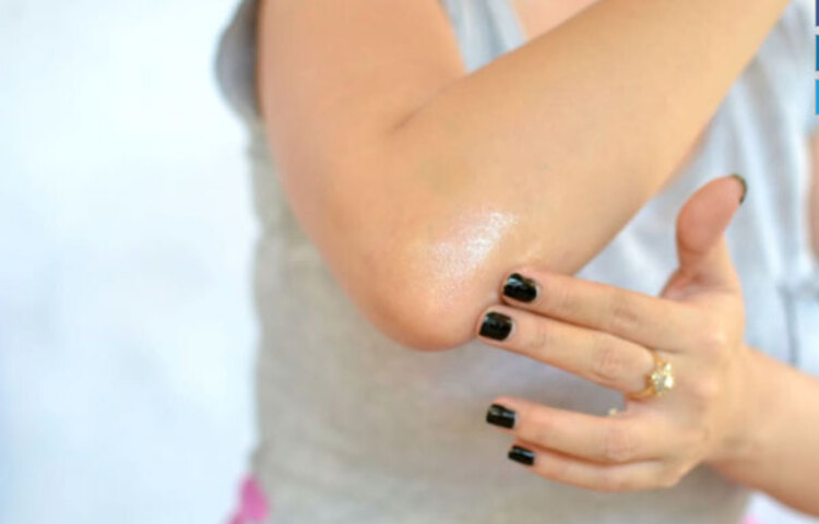 কনুই: কনুই ক্রমাগত সচল থাকে ও ভাঁজ করতে হয়, সে কারণে শরীরের এই অংশের শুষ্কতা আমাদের অস্বস্তিকর অনুভূতি দেয়। আপনি যদি সঠিকভাবে আপনার কনুইয়ের খেয়াল রাখেন এবং নিয়মিত ময়েশ্চারাইজ করেন, তবে একটানা সঞ্চালন হলেও চাপ পড়বে না এবং ত্বক শুষ্ক এবং খরখরে হবে না।