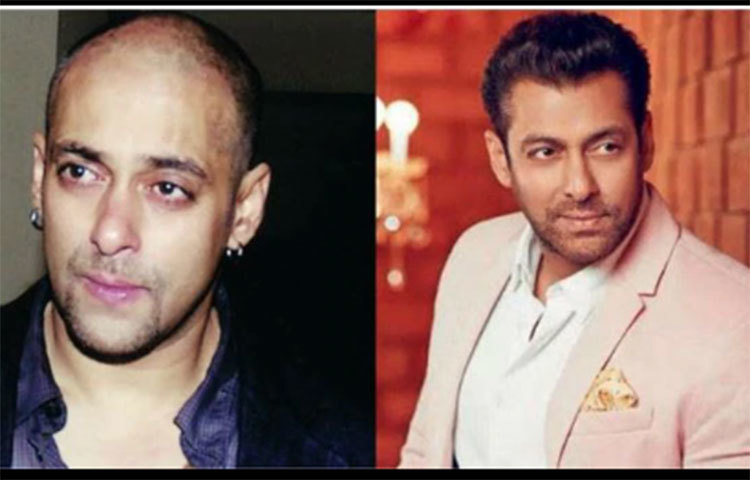 মাথার চুল ক্রমাগত উঠে যাওয়ার কারণে বহুবার চুল ছোট করে কেটে ফেলেছিলেন সালমান। তবুও লাভের লাভ কিছু হয়নি। ভাইজান নাকি ৪বার অস্ত্রপচার সহ হেয়ার ট্রান্সপ্লান্ট করেন।