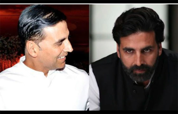 ৪০ বছর বয়সের পর থেকেই নাকি চুল উঠে যাওয়ার সমস্যায় ভুগছিলেন খোদ অক্ষয় কুমার। তিনি নাকি দক্ষিণ আফ্রিকা থেকে হেয়ার ট্রান্সপ্লান্ট করিয়ে আসেন বলে শোনা যায়।