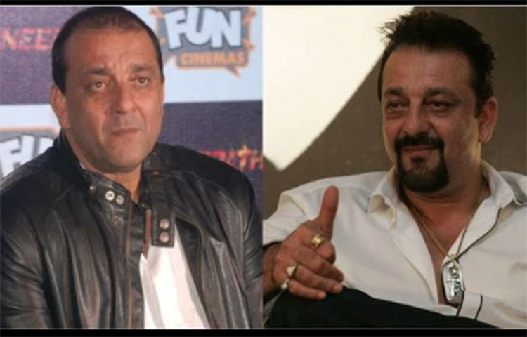 একসময় চুল উঠে যাওয়ার সমস্যায় ভুগছিলেন অভিনেতা সঞ্জয় দত্ত। প্রথমে তিনি মাথার চুল একেবারেই ছোট করে কেটে ফেলেন, তবে তাতেও কোনো লাভ হয়নি। অগত্যা সঞ্জুবাবা নাকি হেয়ার ট্রান্সপ্লান্ট করান।