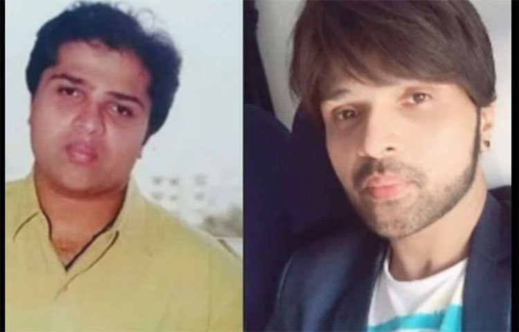 একটা সময় হিমেশ রেশমিয়ার মাথার চুল উঠে যাওয়ার জন্য তিনি প্রায় সর্বক্ষণ টুপি পরে থাকতেন। পরে তাকে সুন্দর ঘন চুলে দেখা যায়। অনেকেই বলেন হিমেশ হেয়ার ট্রান্সপ্লান্ট করিয়েছেন।