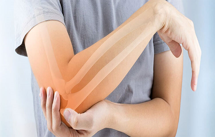 সারাবিশ্বে বয়স পঞ্চাশ বছর ছাড়িয়ে গিয়েছে এমন নারীদের তিনজনের মধ্যে একজন আক্রান্ত হন এই রোগে। তবে পুরুষরাও যে খুব সুরক্ষিত আছেন এমন মনে করার কারণ নেই। পঞ্চাশ ছাড়িয়ে গিয়েছে এমন পুরুষদের ক্ষেত্রে পাঁচ জনের মধ্যে একজন এই রোগে আক্রান্ত হন। এই মুহূর্তে সারাবিশ্বে প্রায় ২০ কোটি মানুষ অস্টিওপোরোসিস রোগে আক্রান্ত। ছবি: সংগৃহীত