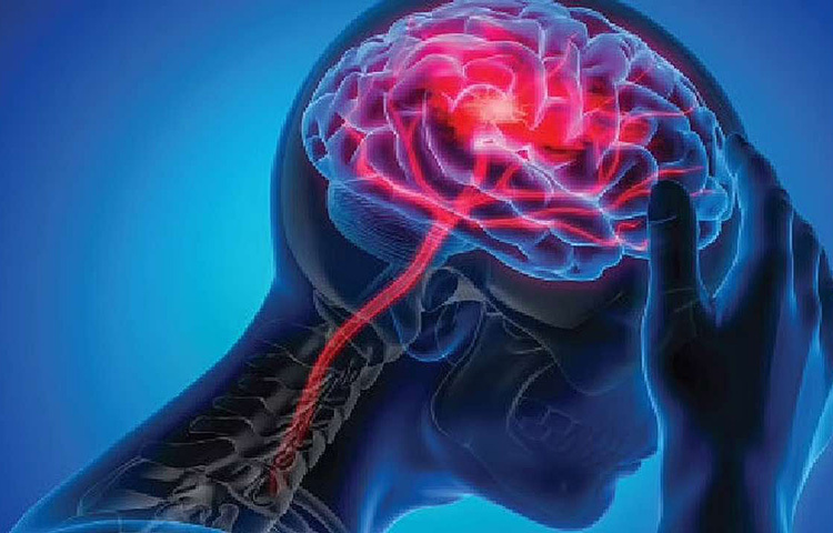 ব্রেনের বিভিন্ন অংশে রক্ত সঞ্চালন ঠিক মতো না হলে ব্রেন স্ট্রোক ঘটে। ব্রেনের টিস্যুতে সঠিকভাবে অক্সিজেন ও পুষ্টি না পৌঁছনোর ফলেও এটি হয়। ছবি: সংগৃহীত