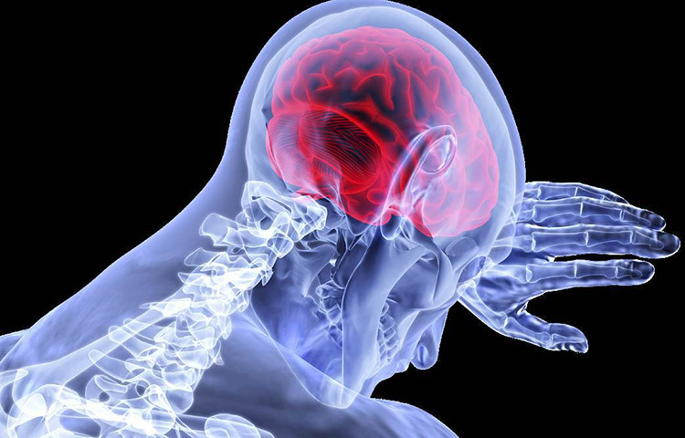 ব্রেন স্ট্রোকের ঝুঁকি কমাতে সবার আগে প্রয়োজন পর্যাপ্ত ঘুম। শুধু তাই নয়, রাতে সময় মেনে ঘুমোনো ও নিয়মিত সকালে ওঠা অভ্যাস করা একান্ত প্রয়োজন। প্রাপ্তবয়স্কদের কমপক্ষে ৭-৮ ঘণ্টা ঘুমোনোর পরামর্শ দিচ্ছেন চিকিৎসকেরা। এর ফলে শরীরে নানান উপকার হয়। কর্মব্যস্ত জীবনে আজকাল অনেকেই সঠিক সময়ে ঘুমান না। প্রতিদিন ঘুমের ব্যাঘাত ঘটলেই ব্রেন স্ট্রোক অনিবার্য। ছবি: সংগৃহীত