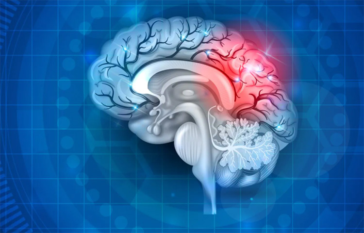 উপরোক্ত বিষয়গুলির পাশাপাশি ব্রেন স্ট্রোকের অন্যতম কারণ হলো শরীরচর্চা না করা। ইয়ং জেনারেশনের ক্ষেত্রে এই উদাসীনতা ভীষণভাবে লক্ষণীয়। নিয়মিত ব্যায়ামের ফলে ব্রেন স্ট্রোকের ঝুঁকি অনেকাংশে কমানো যায়। শুধু তাই নয়, এর ফলে ব্রেনে রক্তের সঞ্চালনও সঠিকভাবে ঘটে। শরীরচর্চার অভাবে দেহের ওজন বাড়ে। যার ফলে ব্রেন স্ট্রোকের ঝুঁকিও বেড়ে চলে। তাই নিয়মিত শরীরচর্চার অভ্যাস করতে হবে। ছবি: সংগৃহীত