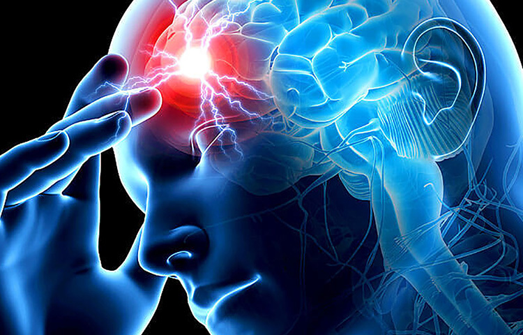 যেভাবে বুঝবেন শরীরে ব্রেন স্ট্রোকের ঝুঁকি বাড়ছে। এই লক্ষণগুলো দেখলে অবশ্যই সতর্ক হোন। প্রয়োজনে চিকিৎসকের পরামর্শ নিন। ব্রেন স্ট্রোকের লক্ষণগুলো হলো, কথা বুঝতে না পারা, কথা বলতে অসুবিধা হওয়া, শরীরে ক্লান্তি ও ঘুম ঘুম ভাব, মনসংযোগ হারিয়ে ফেলা, ধীরে ধীরে দৃষ্টিশক্তি ক্ষীণ হয়ে যাওয়া, হাতে পায়ে অসাড় অবস্থা অনুভব করতে পারেন। ছবি: সংগৃহীত