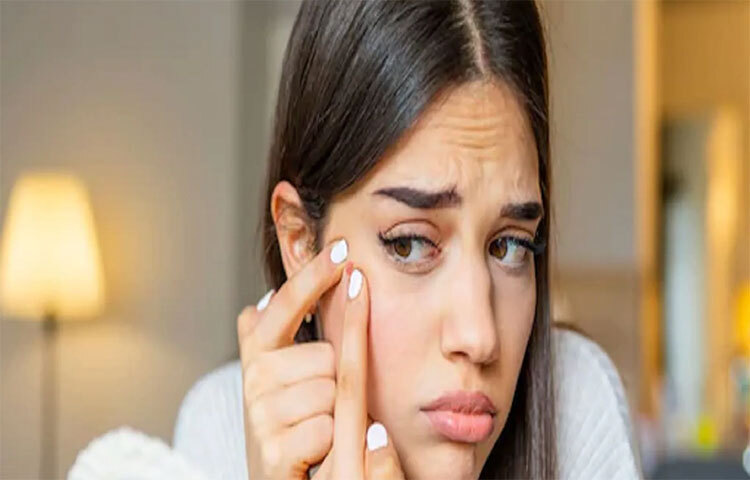 মেকআপ তুলতে হবে: রাতে বাড়ি ফিরেই বিছানায় এলিয়ে যায় শরীর। সারাদিনের ক্লান্তিতে অনেকেরই আর মেকআপ তোলার মতো ধৈর্য থাকে না। এটা ক্ষতিকর। মেকআপের রাসয়নিক ত্বকের সঙ্গে প্রতিক্রিয়া করতে পারে, যার ফলে দাগ এবং ব্রন হয়।তাই যত কষ্টই হোক উপযুক্ত ক্লিনজার দিয়ে পুরো মেকআপ তুলতেই হবে। ছবি: সংগৃহীত