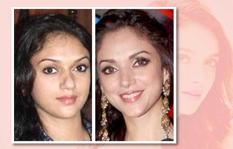 অদিতি রায় হায়দারি: নাক নিয়ে সন্তুষ্ট ছিলেন না অভিনেত্রী অদিতি রায় হায়দারি। টিকালো নাকের জন্য তিনিও করেছেন নোজ জব। শুধু তাকি নয়, শোনা যায় ‘পারফেক্ট জ লাইন’-এর জন্যও নাকি অস্ত্রোপচারের সাহায্য নিয়েছিলেন তিনি।