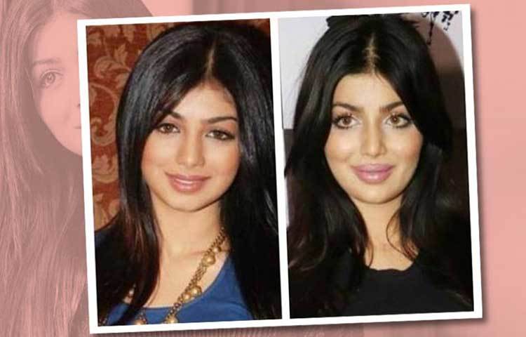 আয়েশা টাকিয়া: ক্যারিয়ার শুরু করেছিলেন ‘কমপ্ল্যান গার্ল’ হিসেবে। ধীরে ধীরে পা রাখেন সিনেমা জগতেও। ‘ডোর’, ‘ওয়ান্টেড’ সহ বেশ কিছু ছবি সাফল্যও লাভ করে বক্স অফিসে। কিন্তু হঠাৎই ২০১৭ নাগাদ আয়েশার একটি ছবি সোশ্যাল মিডিয়ায় ভাইরাল হয়ে যায়। আঁতকে উঠেছিলেন তার অনুরাগীরা। এ কোন আয়েশা! ‘বেবি ফেস’-এর জন্যই যিনি মূলত জনপ্রিয় ছিলেন, প্লাস্টিক সার্জারি করে একেবারেই নিজেকে বদলে ফেলেছেন তিনি।