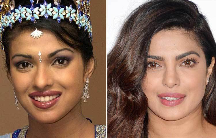প্রিয়াঙ্কা চোপড়া: মিস ওয়ার্ল্ড জেতার সময়কার প্রিয়াঙ্কা আর এখনকার প্রিয়াঙ্কার চেহারার মধ্যে আকাশ-পাতাল ফারাক। বয়সের কারণে কিছুটা অমিল থাকবেই কিন্তু ভাল করে লক্ষ্য করলে দেখা যাবে প্রিয়াঙ্কাও লিপ জবের আশ্রয় নিয়েছেন। বদলে ফেলেছেন ঠোঁটের আকৃতি। যদিও এ বিষয়ে তাকে বারংবার প্রশ্ন করা হলে প্রত্যেকবারেই অস্বীকার করেছেন নিক-ঘরণী। বলি অভিনেত্রীদের মধ্যে তিনিই প্রথম যে লিপ জব করানোর সাহস দেখিয়েছিলেন।
