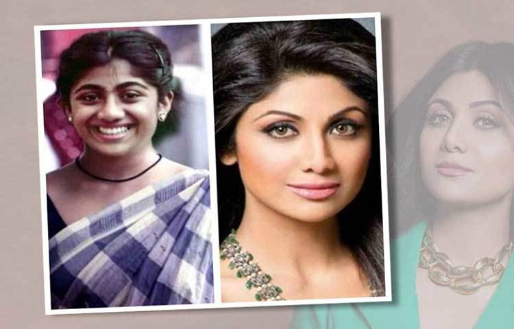 শিল্পা শেটি: নিজের নাকের আকার নিয়ে মোটেও খুশি ছিলেন না অভিনেত্রী শিল্পা শেটি। এখন পর্যন্ত দুবার নোজ জব করিয়েছেন তিনি। তবে তা নিয়ে মোটেও লুকোছাপা করেননি শিল্পা। প্রকাশ্যে স্বীকারও করে নিয়েছেন। নেটিজেনদের মতে, আয়েশার মতো তার ক্ষেত্রে প্লাস্টিক সার্জারি ‘ব্যাকফায়ার’ হয়ে দাঁড়ায়নি। বরং আখেরে লাভই হয়েছে। অভিনেত্রী নিজেও তার বর্তমান লুক নিয়ে বেজায় খুশি।