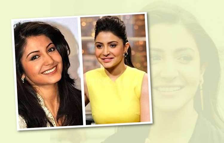 অনুশকা শর্মা: ‘লিপ জব’ শুনলেই প্রথমেই যে বলি অভিনেত্রীর কথা মাথায় আসে তিনি হলেন অনুশকা শর্মা। ‘পিকে’ ছবিতে অনুশকার ঠোঁট দেখে চমকে গিয়েছিলেন তার ফ্যানেরা। অনুশকাও স্বীকার করে নিয়েছিলেন লিপ জব করিয়েছেন তিনি। তবে বিরাট পত্নীর দাবি ছিল, ছবির প্রয়োজনেই নাকি লিপ জব করিয়েছিলেন তিনি। পরে অবশ্য কোনো উপায়ে নিজের ঠোঁট আগের অবস্থায় ফিরিয়ে নিয়ে গিয়েছিলেন অভিনেত্রী। কীভাবে সে কথা শেয়ার করেননি কখনোই।