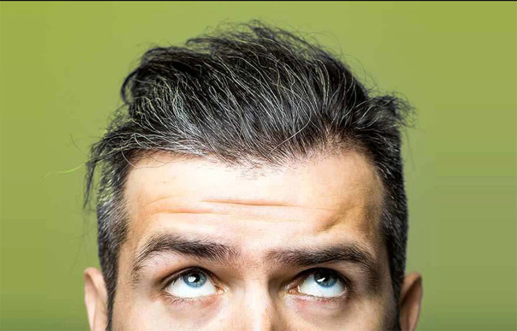 চুল পাকার একটা নির্দিষ্ট বয়স আছে। সময়ের আগে চুল পেকে যাওয়ার বিভিন্ন কারণ আছে। এটা মানসিক চাপের জন্য হতে পারে, বংশগত কারণে হতে পারে, আবার অতিরিক্ত ধূমপান বা মদ্যপানের জন্যও হতে পারে। আবার অনেক সময়ে দেখা যাচ্ছে কয়েকটি কুঅভ্যাসের জন্য সময়ের আগেই চুলে পাক ধরছে। ছবি: সংগৃহীত