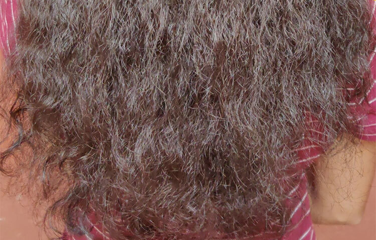 গ্রীষ্মকালে শুধু মুখের ত্বকই নয়, মাথার স্কাল্পও তেলা হয়ে যায়। ঠিক তেমনই শীতকালে মুখের ত্বকের ও স্কাল্পও রুক্ষ হয়ে যায়। ফলে চুলে জট পড়াসহ অন্যান্য সমস্যা দেখা যায়। নিয়মিত টক দই মাখলে এই সমস্যা থেকে মুক্তি পাওয়া যায়। ছবি: সংগৃহীত