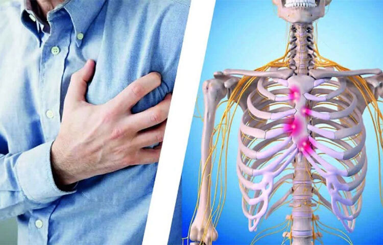 আর একটি আছে, কস্টোকনড্রাইটিস। আমাদের ব্রেস্টবোনে কতগুলো কার্টিলেজ থাকে। এগুলো রিব বা পাঁজরগুলোকে ধরে রাখে। এই কার্টিলেজ বা তরুণাস্থিতে অনেক সময়ে প্রদাহ হয়। এর ফলেও এমন কষ্ট হয় যেটাকে অনেকে হার্ট অ্যাটাকের কষ্ট বলে মনে করে বসেন। ছবি: সংগৃহীত