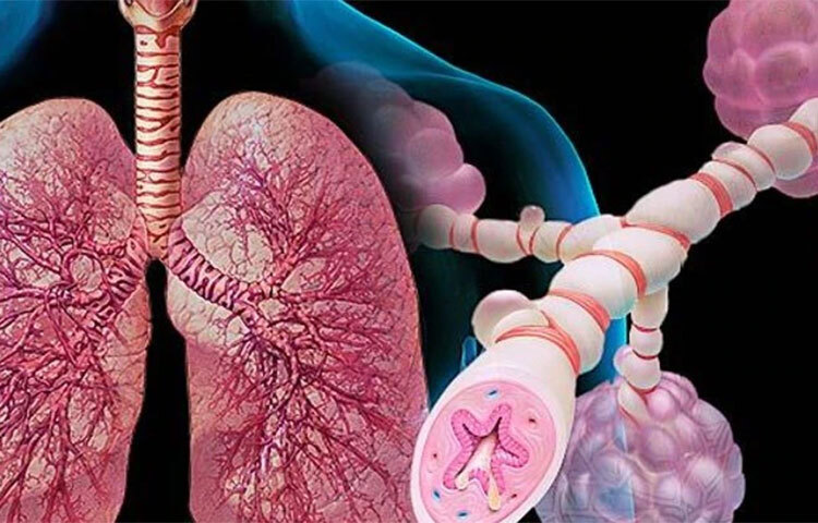 অ্যাজমার সঙ্গে আমরা কম-বেশি সকলেই পরিচিত। এই রোগটিতে আমাদের শ্বাসযন্ত্রের এয়ারওয়েজগুলো সংকীর্ণ হয়ে পড়ে বা ফুলে যায়। এর ফলে সেখানে অতিরিক্ত মিউকাস তৈরি হয় ও তা জমতে থাকে। এর ফলে শ্বাস নিতে কষ্ট হয়। কাশি হয়। গলার আওয়াজ ফ্যাঁসফেঁসে হয়ে যায়। ছবি: সংগৃহীত