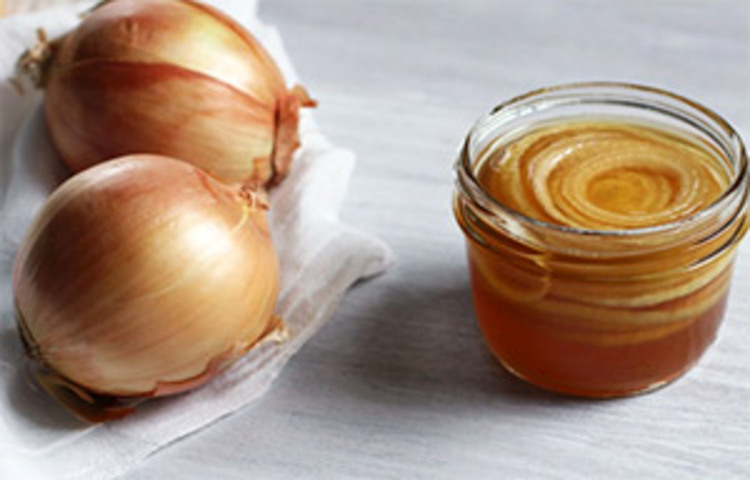 ঠান্ডা লাগা: শীতকালে আবহাওয়ার পরিবর্তন আর ঠান্ডা লাগার কারণে নানা ধরনের ভাইরাল জ্বর ও সংক্রমণ দেখা যায়। নাক বন্ধ হয়ে যাওয়া, গলা ব্যথা, গলায় সংক্রমণসহ একাধিক সমস্যা হয়। এক্ষেত্রে পেঁয়াজে উপস্থিত ফ্ল্যাভোনয়েড কোরসেটিন শুধুমাত্র অ্যান্টিঅক্সিড্যান্ট নয়, অ্যান্টি-ইনফ্ল্যামেটরি উপাদান হিসেবে কাজ করে। আর ঠান্ডা লাগার সমস্যাগুলো দূর করে। ছবি: সংগৃহীত