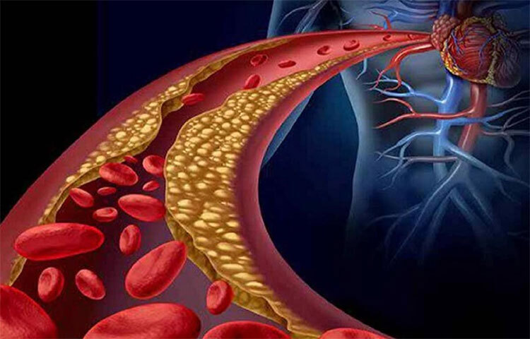 মধুও কোলেস্টেরল নিয়ন্ত্রণ করতে পারে। তবে মধুর সঙ্গে রসুন খেলে এটি বিশেষভাবে কাজ করে। ছবি: সংগৃহীত