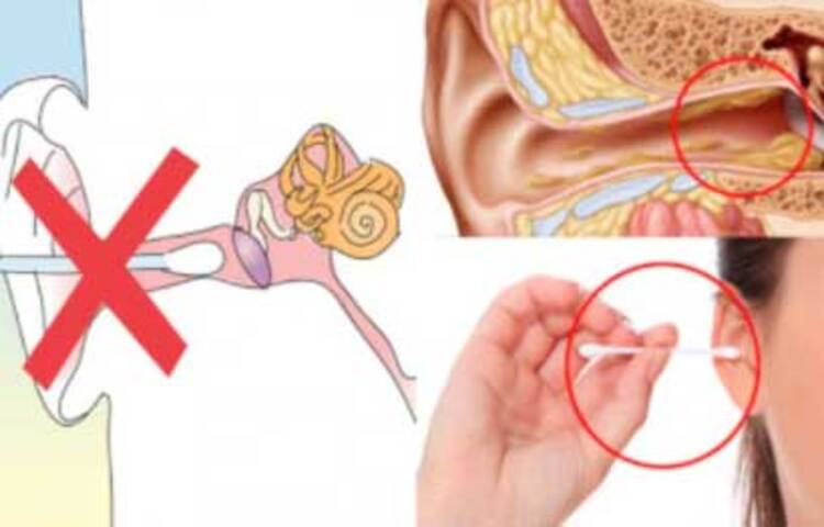 জনস্বাস্থ্য বিশেষজ্ঞরা বলছেন কান রোজ পরিষ্কার করা ভালো নয়। কটন বাড দিয়ে কান পরিষ্কার করে নিজেই নিজের বিপদ ডেকে আনছেন।
