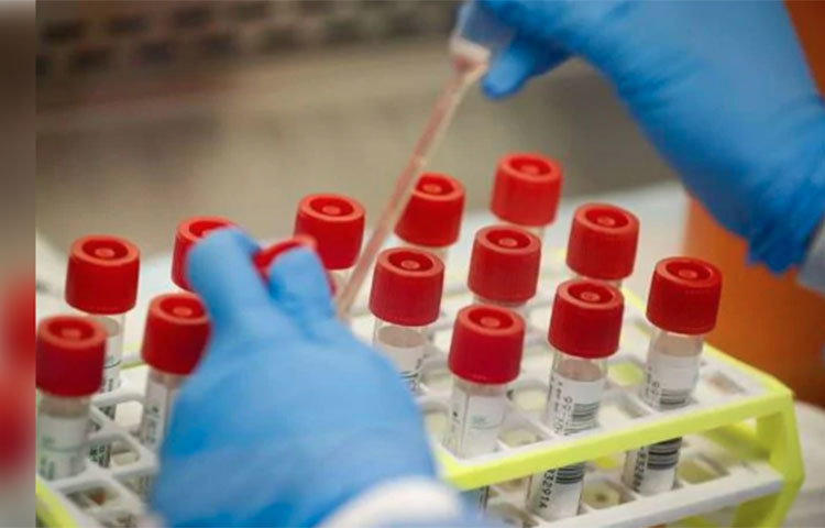 যদি দ্বিতীয় ধাক্কা নাও আসে, তাহলেও বেশ কিছু দেশে ফের একবার চূড়ান্ত পর্যায়ে পৌঁছতে পারে সংক্রমণ।