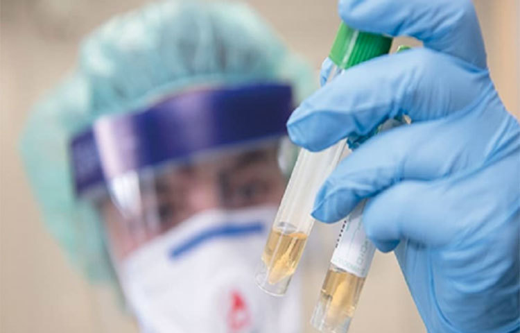 বিশ্বের যে দেশগুলোতে করোনা মারাত্মক আকার নিয়েছে, সেখানে একটি পর্যায়ে খুব বেশি সংখ্যক সংক্রমণ এবং মৃত্যুর ঘটনা ঘটেছে। এই সময়টিকেই বলা হয় সংক্রমণের চূড়ান্ত পর্যায়ে পৌঁছনো বা পিক বলা হয়। বিশ্ব স্বাস্থ্য সংস্থা সতর্ক করে বলছে, এই 'ফার্স্ট ওয়েভ'-এর মধ্যে 'সেকেন্ড পিক'-এর মুখোমুখি হতে পারে বিশ্ব।