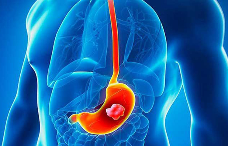 টক দইয়ের সঙ্গে কিসমিস মিশিয়ে খেলে অন্ত্রে উপকারী ব্যাকটেরিয়ার পরিমাণ বৃদ্ধি পায়। যার ফলে সার্বিকভাবে স্বাস্থ্যের উন্নতি হয়। দু’রকমভাবে কাজ করে এই কম্বিনেশন। চিকিৎসকরা বলছেন, পাচন প্রক্রিয়াকে ব্যাহত করে এমন বাজে ব্যাকটেরিয়াকে বিনাশ করে এবং উপকারী ব্যাকটেরিয়া উৎপন্ন করে দই কিসমিসের এই মিশ্রণ। ছবি: সংগৃহীত