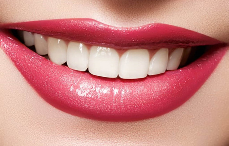 টক দইয়ের সঙ্গে কিসমিস মিশিয়ে খেলে দাঁত ও মাড়ি ভালো থাকবে। দাঁতের উজ্জ্বলতা থেকে পাইরিয়া পর্যন্ত ঠিক করে দিতে পারে। খাওয়ার পরে স্ন্যাক্স হিসেবেও খেতে পারেন দই কিসমিসের মিশ্রণ। ছবি: সংগৃহীত