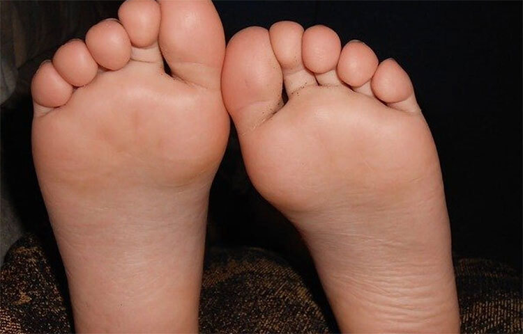 পা উষ্ণ থাকা: হঠাৎ করে যদি আপনার পা গরম হয়ে যায় তাহলেও সচেতন হতে হবে। কারণ নিয়মিত পা গরম হওয়াও ডায়াবেটিসের লক্ষণ হতে পারে। আপনি যদি এই ধরনের কোনো উপসর্গ দেখতে পান, তাড়াতাড়ি একজন ডাক্তারের সঙ্গে পরামর্শ করুন। ছবি: সংগৃহীত