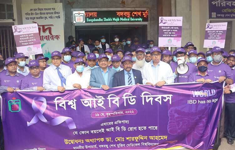 রোগীদের সুবিধার্থে বঙ্গবন্ধু শেখ মুজিব মেডিকেল বিশ্ববিদ্যালয়ে (বিএসএমএমইউ) ইভিনিং শিফটে সার্জারির কার্যক্রম চালু করা হবে বলে জানিয়েছেন বিশ্ববিদ্যালয়ের উপাচার্য অধ্যাপক ডা. মো. শারফুদ্দিন আহমেদ। বিশ্ব আইবিডি দিবস-২০২২ উপলক্ষে আজ সকালে বিশ্ববিদ্যালয়ের শহীদ ডা. মিল্টন হলে আয়োজিত সংক্ষিপ্ত সমাবেশ ও সেমিনারে প্রধান অতিথির বক্তব্যে তিনি এ কথা জানান। ছবি: জাগো নিউজ