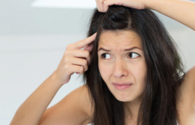 খুশকি দূর করতে টক দইয়ের ব্যবহার করতে পারেন। দই নিয়ে মাথার ত্বক থেকে চুলের গোড়ায় লাগিয়ে নিন। ২০ মিনিট রেখে ধুয়ে ফেলুন চুল। কিছুদিন এই পদ্ধতি মেনে চললে দূর হয়ে যাবে খুশকি। ছবি: সংগৃহীত