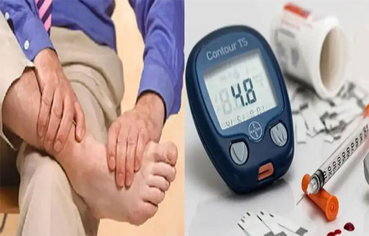 পায়ের নিচে বা বুড়ো আঙুলের নিচে ফোসকা পড়ে, ঘা অথবা আলসার হয়ে যায়। পায়ের আকৃতি পরিবর্তনও হয়ে যায়। ছবি: সংগৃহীত