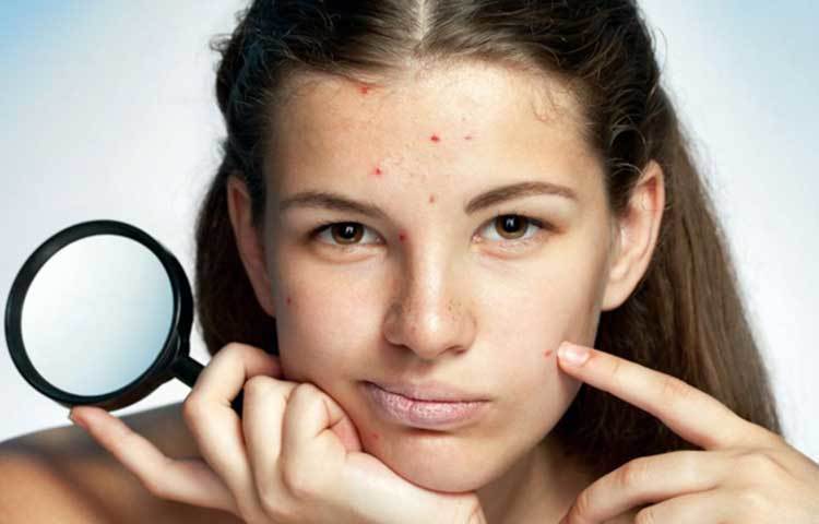 ত্বকের সমস্যা: ত্বক শরীরের গুরুত্বপূর্ণ অংশ। ত্বকে র‌্যাশ, একজিমা, সংক্রমণও শরীরের এক ধরনের বার্তা। শরীর এ রকম পরিস্থিতিতে কোনো গোলযোগের সংকেত দেয়। পুষ্টির অভাব, অ্যালার্জি থেকেও এমনটা হতে পারে।