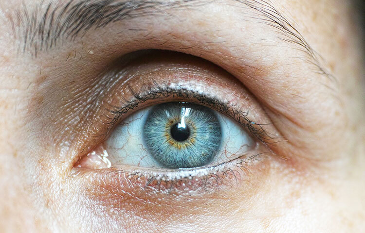 ডায়াবেটিস: ঝাপসা দৃষ্টি চোখের একটা সাধারণ সমস্যা। তবে টাইপ ২ ডায়াবেটিস হলেও এমনটা হতে পারে। দীর্ঘদিন ধরে হাই ব্লাড সুগার থাকলে রক্তনালীতে চাপ সৃষ্টি হয়, ফলে চোখে রক্তের মতো লাল দাগ দেখা যায়। চোখে এমন দাগ দেওয়ার অর্থ, রক্তে শর্করার মাত্রা বিপজ্জনক পর্যায়ে পৌঁছেছে। তাই দ্রুত চিকিৎসকের পরামর্শ নেওয়া জরুরি। না হলে অন্ধত্ব নেমে আসতে পারে। ছবি: সংগৃহীত