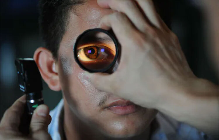 বার্ধক্যজনিত কারণে, শরীরের অন্য অসুখের কারণে, চোখের কোনো অসুখের জটিলতার ফলে ও আঘাতজনিত কারণে আমদের চোখে যে কোনো বয়সে ছানি পড়তে পারে। ছবি: সংগৃহীত