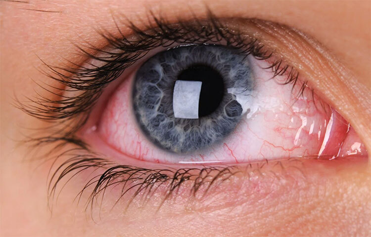 কনট্যাক্ট লেন্স আগে দেখবেন হাতে যাতে কোনো ধরনের মেকআপ বা নোংরা না লেগে থাকে। খোলার সময়েও মাথায় রাখবেন। ছবি: সংগৃহীত